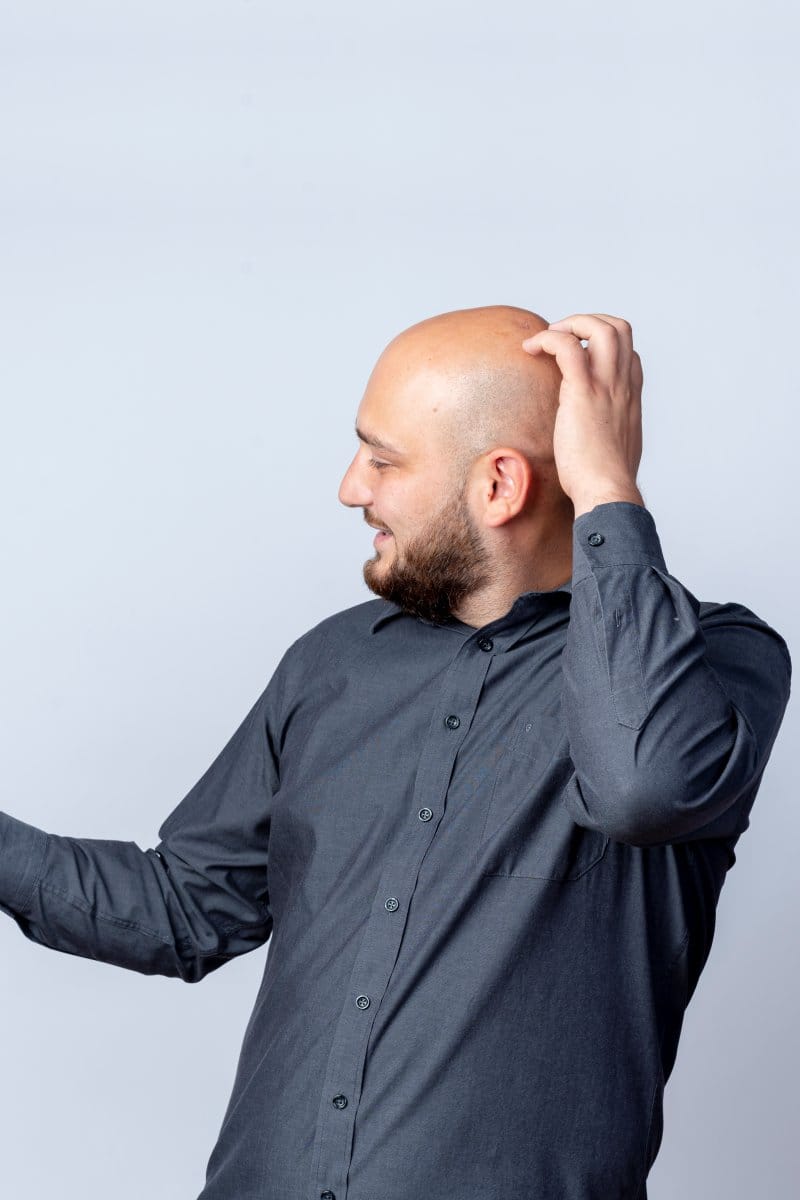PRP for Hair Loss